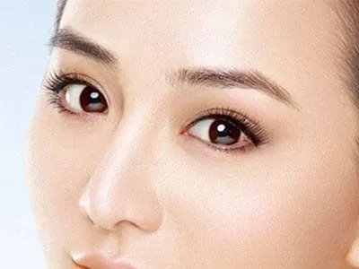 双眼皮全切是什么意思