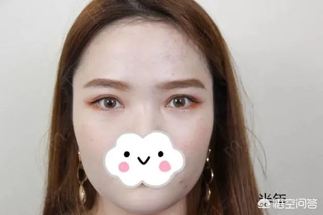 做双眼皮有几种方法？