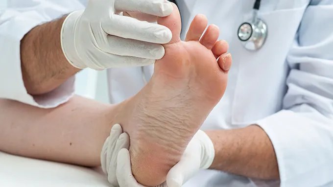 水泡脚气的治疗方法都有哪些 水泡脚气该如何进行用药