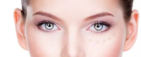 内切去眼袋优势