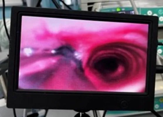 厉害了!广医五院麻醉科医生竟有“第三只眼”,引领“舒适化诊疗”新体验!