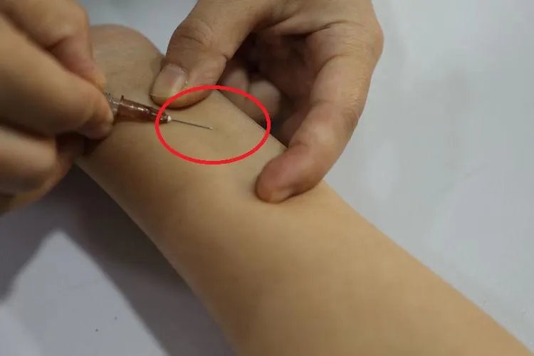 做皮试的正确部位图解