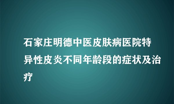 石家庄明德中医皮肤病医院特异性皮炎不同年龄段的症状及治疗