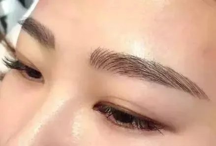 植眉毛一般要多少钱