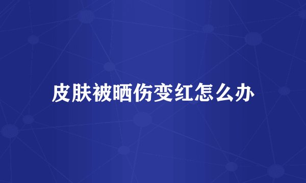 皮肤被晒伤变红怎么办