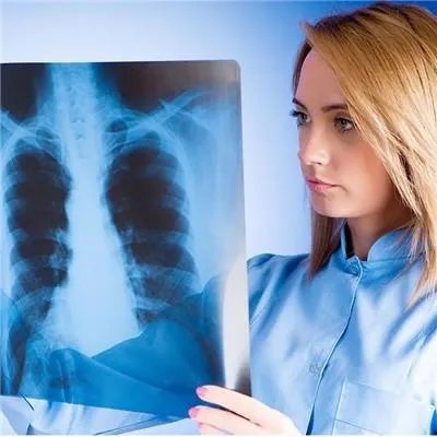 肺癌晚期还有救吗