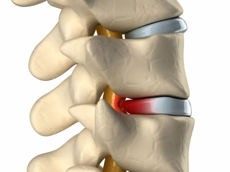 震颤麻痹是什么意思