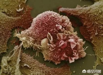 动作演员计春华因肺癌去世,对此你怎么看?