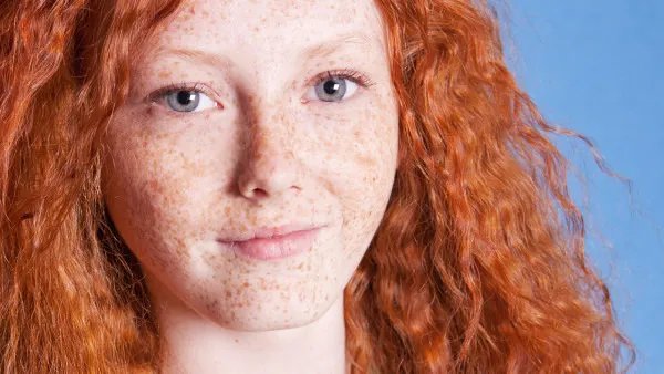 激光祛斑危害有哪些