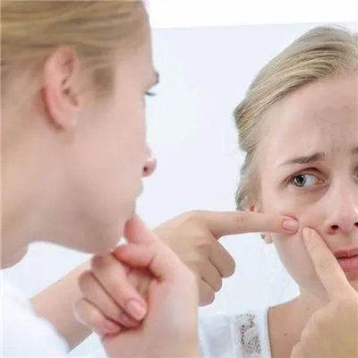 脸上脸上长痘痘怎么办