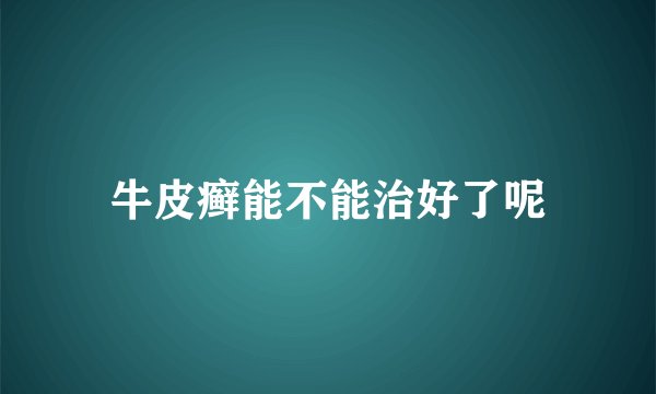 牛皮癣能不能治好了呢