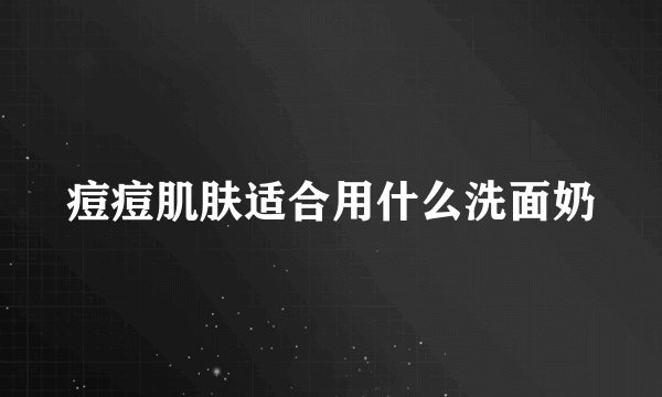 痘痘肌肤适合用什么洗面奶