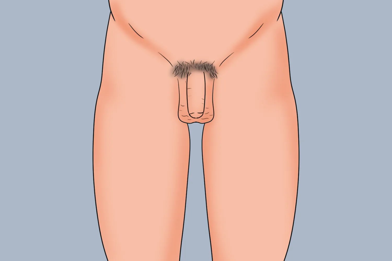 12岁男宝的阴茎应该是什么样