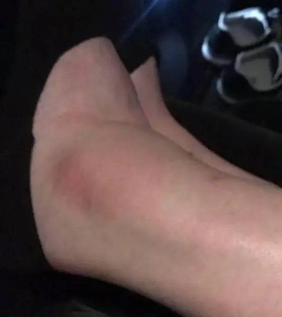 2017维秘秀奚梦瑶摔倒，你怎么看？