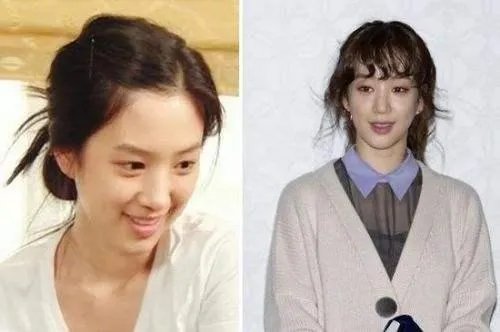 娱乐圈有哪些本来就长得很好看却还整容的明星？