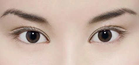 眼部抽脂多少钱