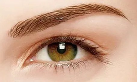 开内眼角多久恢复自然