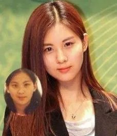 徐贤真整容 图片:徐贤真尴尬颁奖典礼