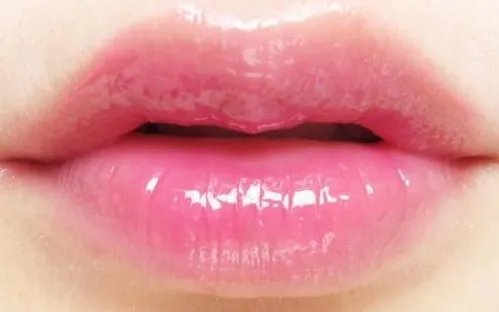 嘴唇注射玻尿酸安全吗