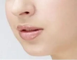 北京最好的整形医院下巴吸脂的价格