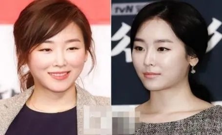 徐贤真整容 图片：徐贤真尴尬颁奖典礼