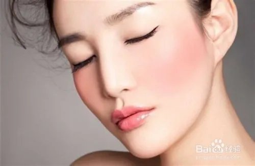 脸上的红血丝怎样处理