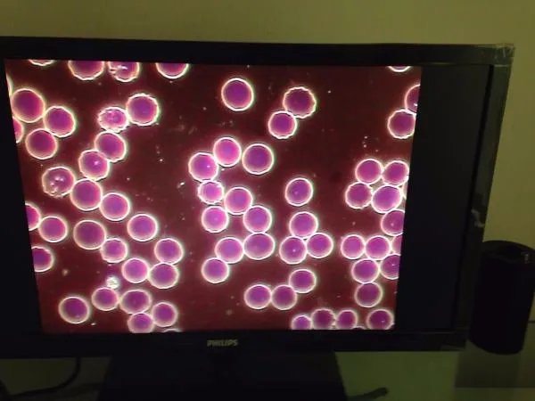 一滴血检测仪怎么看干血，什么原理，对比图是什么？