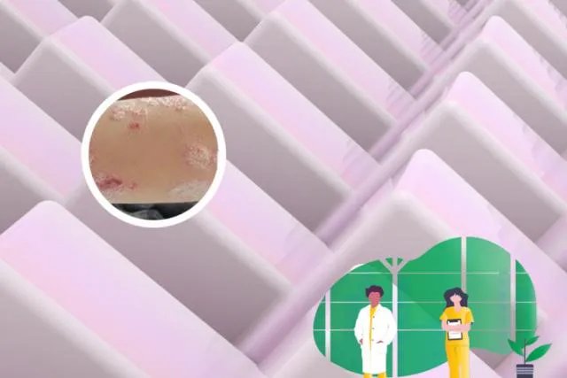 可善挺能保几年不复发