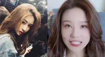 网红温精灵被吐槽整容失败,你还知道哪些整容失败的网红?