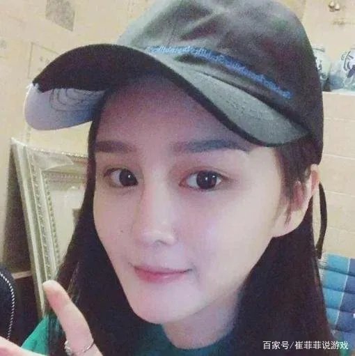 赵本山妻子谈女儿整容,坦言看着很揪心,女儿整容她该不该阻止?