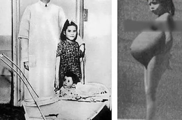 世界上最年轻的一对父母:年仅五岁你信吗?