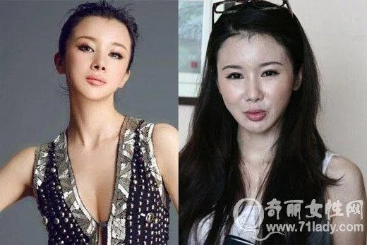 娱乐圈有哪些本来就长得很好看却还整容的明星？