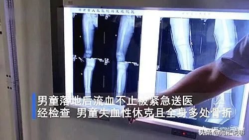 长沙6岁男童被锁家中撑伞从5楼跳下，全身多处骨折，怎么回事？