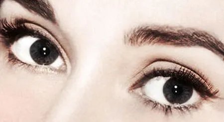 双眼皮修复要多少钱