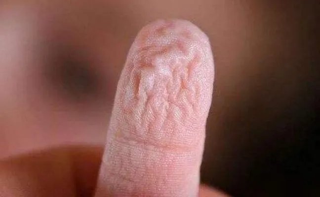 手指泡水就会起皱竟暗示这一事（图）