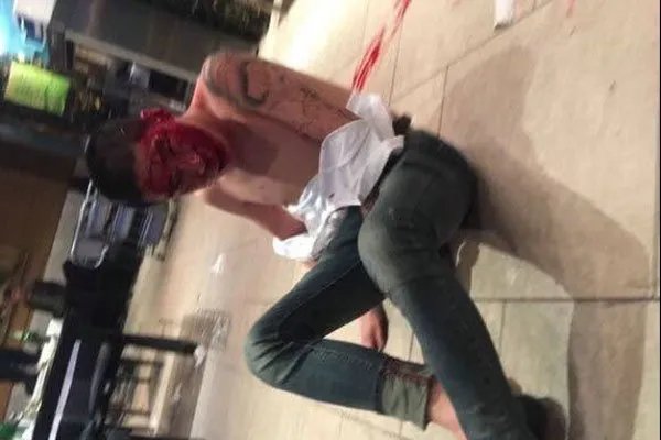 刘一手被谁打的一脸血 大主播当众挨揍受伤丢面子