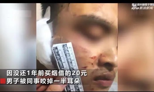 没还钱被咬掉耳朵怎么回事：事件始末经过及后续结果