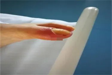 糖尿病真实图片大全