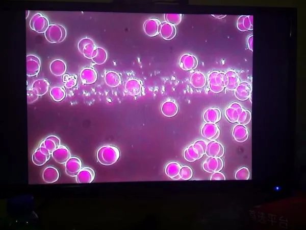 一滴血检测仪怎么看干血，什么原理，对比图是什么？