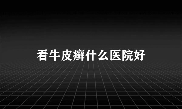 看牛皮癣什么医院好