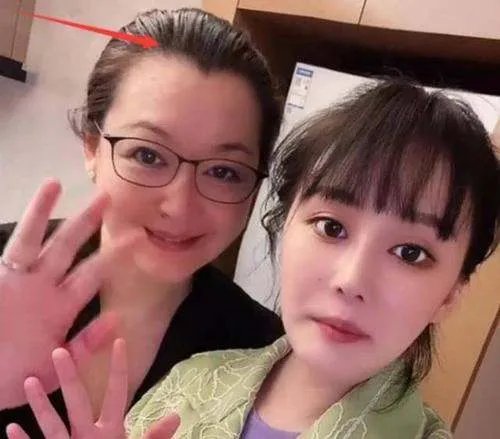 赵本山妻子谈女儿整容,坦言看着很揪心,女儿整容她该不该阻止?