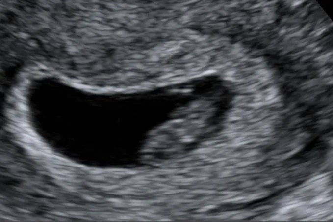 50天胎儿b超的样子图片