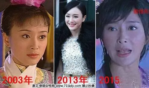 娱乐圈有哪些本来就长得很好看却还整容的明星？