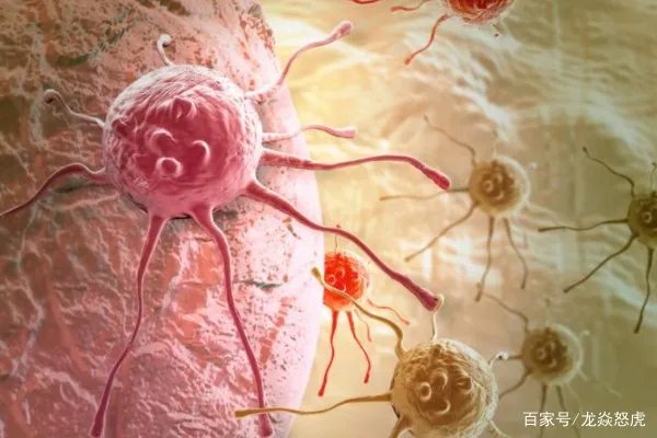 姚贝娜乳腺癌早期为什么只活了三年？