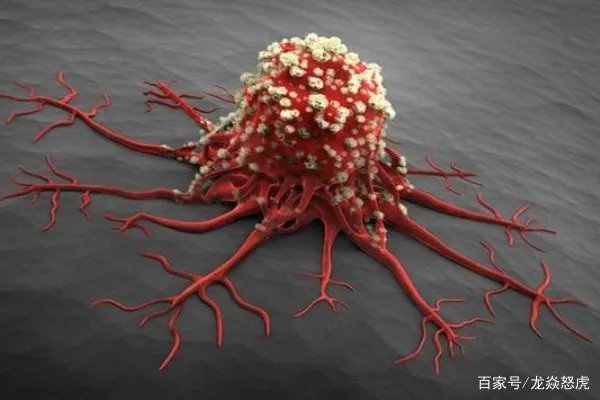 姚贝娜乳腺癌早期为什么只活了三年？