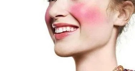 脸上的红血丝怎样处理