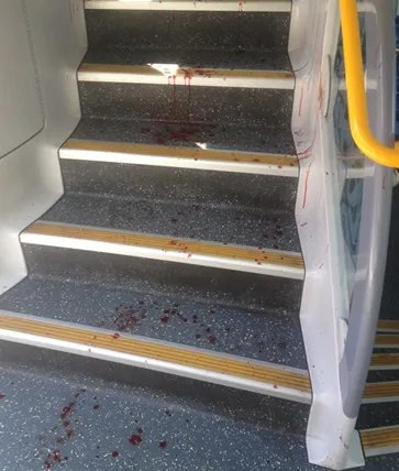 有关悉尼火车撞缓冲器的详细介绍?