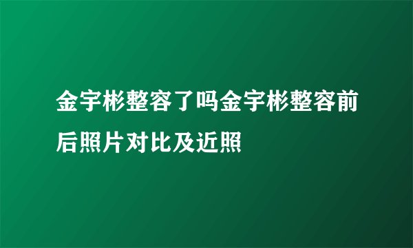 金宇彬整容了吗金宇彬整容前后照片对比及近照