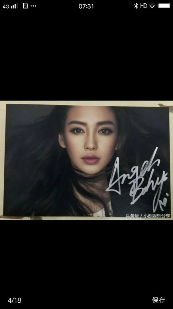 娱乐圈有哪些本来就长得很好看却还整容的明星？