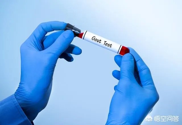 双黄连注射液被药监局宣布儿童禁用，你怎么看？